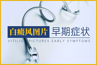 领居家小妹妹身上有白斑是不是白癞风呢